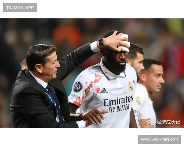 皇马迎后防利好：吕迪格米利唐回归，赫伊森继续伤缺